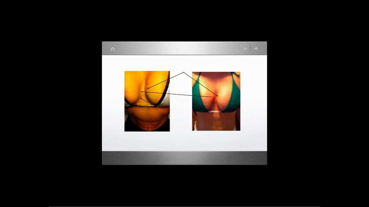 youtube placeholder image